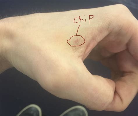 how to disable rfid chip implant|I got a computer chip implanted into my hand. Here's .